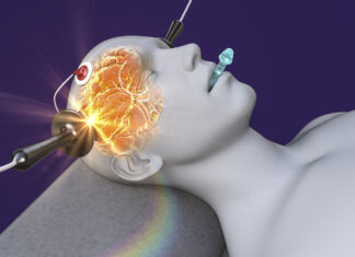 Deltakere søkes til internasjonal online ECT-studie