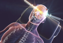 Hvis god helse er et mål, bør vi ikke gi elektrosjokk med tvang