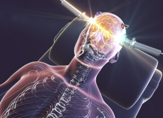 Hvis god helse er et mål, bør vi ikke gi elektrosjokk med tvang